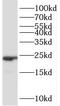 Peptidylprolyl Isomerase B antibody, FNab10219, FineTest, Western Blot image 