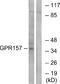 G Protein-Coupled Receptor 157 antibody, A30818, Boster Biological Technology, Western Blot image 