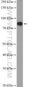 Uncharacterized protein C1orf103 antibody, 26115-1-AP, Proteintech Group, Western Blot image 