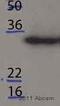 Microtubule Associated Protein RP/EB Family Member 1 antibody, ab53358, Abcam, Western Blot image 