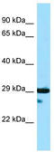 Dystrobrevin Binding Protein 1 antibody, TA342949, Origene, Western Blot image 
