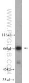 MAX Network Transcriptional Repressor antibody, 23742-1-AP, Proteintech Group, Western Blot image 