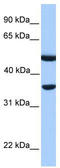 DnaJ homolog subfamily B member 6 antibody, TA340235, Origene, Western Blot image 