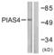 Protein Inhibitor Of Activated STAT 4 antibody, abx013226, Abbexa, Western Blot image 