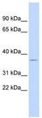 Dual specificity protein phosphatase 12 antibody, TA332009, Origene, Western Blot image 