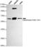 Cytochrome P450 Family 17 Subfamily A Member 1 antibody, TA346928, Origene, Western Blot image 