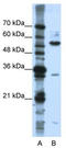 KH RNA Binding Domain Containing, Signal Transduction Associated 3 antibody, TA345974, Origene, Western Blot image 