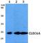 C-Type Lectin Domain Containing 6A antibody, A11863, Boster Biological Technology, Western Blot image 