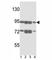 ATP Binding Cassette Subfamily B Member 5 antibody, F49442-0.4ML, NSJ Bioreagents, Western Blot image 