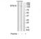 Serine/threonine-protein kinase 10 antibody, TA314577, Origene, Western Blot image 