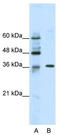 Zinc Finger Protein 124 antibody, TA343393, Origene, Western Blot image 