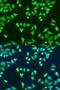 Survival Of Motor Neuron 2, Centromeric antibody, LS-C747605, Lifespan Biosciences, Immunofluorescence image 