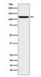 Ubiquitin Specific Peptidase 7 antibody, M01239, Boster Biological Technology, Western Blot image 