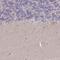 Mitochondrial Ribosomal Protein S18B antibody, NBP2-48958, Novus Biologicals, Immunohistochemistry paraffin image 