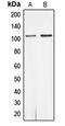 Androgen Receptor antibody, orb215606, Biorbyt, Western Blot image 