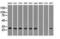 Replication Protein A2 antibody, NBP2-02182, Novus Biologicals, Western Blot image 