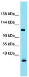 KIAA0355 antibody, TA337376, Origene, Western Blot image 