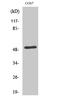 Endothelin Receptor Type A antibody, STJ93004, St John