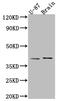 Nerve Growth Factor antibody, CSB-RA288635A0HU, Cusabio, Western Blot image 