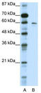 Potassium voltage-gated channel subfamily G member 1 antibody, TA338523, Origene, Western Blot image 