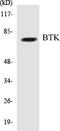 Bruton Tyrosine Kinase antibody, EKC1068, Boster Biological Technology, Western Blot image 