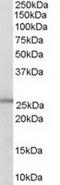 Glutathione S-Transferase Mu 1 antibody, TA302987, Origene, Western Blot image 