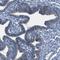 Desmocollin 1 antibody, NBP1-88099, Novus Biologicals, Immunohistochemistry frozen image 