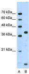 FXYD Domain Containing Ion Transport Regulator 5 antibody, TA338571, Origene, Western Blot image 
