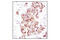 Prolyl 4-Hydroxylase Subunit Beta antibody, 2446S, Cell Signaling Technology, Immunohistochemistry paraffin image 