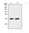 Natriuretic Peptide A antibody, A01318, Boster Biological Technology, Western Blot image 