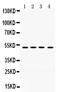 Kim1 antibody, RP1093, Boster Biological Technology, Western Blot image 