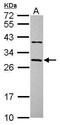 Coiled-Coil Domain Containing 70 antibody, PA5-31679, Invitrogen Antibodies, Western Blot image 
