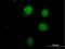 Putative Homeodomain Transcription Factor 1 antibody, H00010745-B01P, Novus Biologicals, Immunofluorescence image 