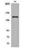 Ankyrin Repeat Domain 30A antibody, orb159937, Biorbyt, Western Blot image 