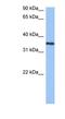 Heterogeneous Nuclear Ribonucleoprotein A2/B1 antibody, NBP1-57166, Novus Biologicals, Western Blot image 