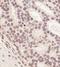 RING1b antibody, A302-869A, Bethyl Labs, Immunohistochemistry frozen image 
