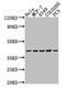 Lysophosphatidic Acid Receptor 2 antibody, CSB-PA013048OA01HU, Cusabio, Western Blot image 