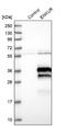 Enkurin, TRPC Channel Interacting Protein antibody, NBP2-34037, Novus Biologicals, Western Blot image 