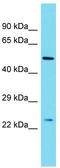 Methyl-CpG Binding Domain Protein 3 Like 2 antibody, TA331339, Origene, Western Blot image 