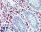 Tryptase Beta 2 (Gene/Pseudogene) antibody, LS-B15253, Lifespan Biosciences, Immunohistochemistry paraffin image 