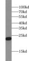 Retinol Binding Protein 4 antibody, FNab07192, FineTest, Western Blot image 