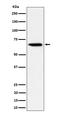 SCP 2 antibody, M02947-1, Boster Biological Technology, Western Blot image 