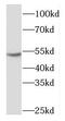 Nuclear Prelamin A Recognition Factor antibody, FNab05551, FineTest, Western Blot image 