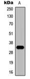 Zinc Finger Protein 75D antibody, LS-C368559, Lifespan Biosciences, Western Blot image 