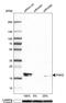 PNKD Metallo-Beta-Lactamase Domain Containing antibody, PA5-52695, Invitrogen Antibodies, Western Blot image 