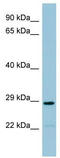 Probable N-acetyltransferase 8B antibody, TA346134, Origene, Western Blot image 