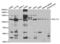 BAF Chromatin Remodeling Complex Subunit BCL11A antibody, abx004168, Abbexa, Western Blot image 