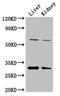 Pantothenate Kinase 2 antibody, CSB-PA874850LA01HU, Cusabio, Western Blot image 