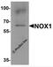 NADPH Oxidase 1 antibody, 7921, ProSci Inc, Western Blot image 
