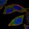 E3 ubiquitin-protein ligase RNF123 antibody, PA5-67213, Invitrogen Antibodies, Immunofluorescence image 